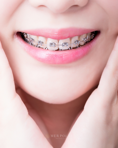 Ortodonti Tedavileri
